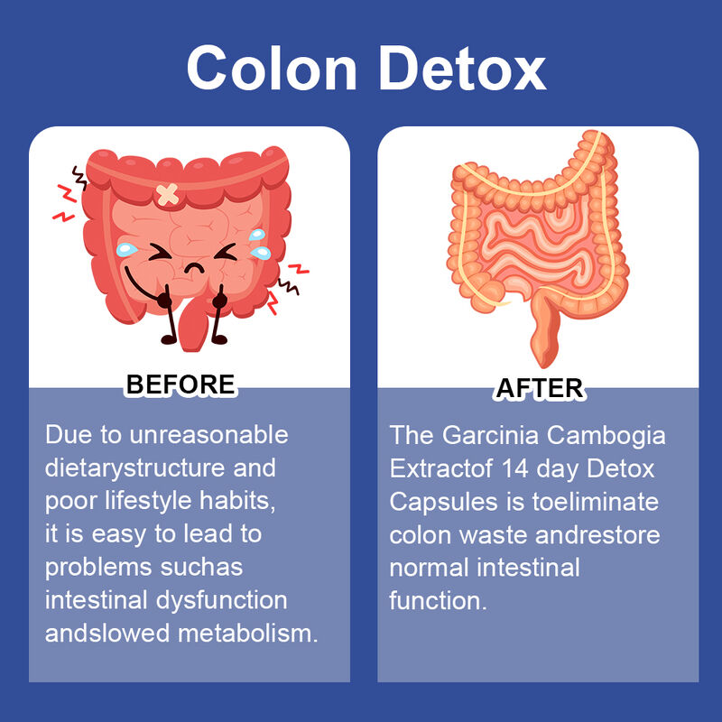 Ιδιωτική Ετικέτα 14 Ημέρες Slim Κάψουλα Υποστηρίζει την Υγεία της Υπαπαπαγωγής και την απώλεια βάρους Συμπλήρωμα Διατροφής Καψούλες Αποτοξίνωσης